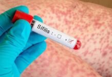 Los casos de sífilis crecieron 38,5% en tres años y alcanzaron un récord en el país