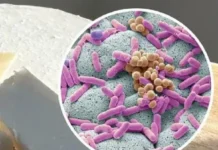 Alerta Sanitaria: Ordenan Retirar del Mercado un Lote de Queso Cremoso por la Peligrosa Bacteria Listeria